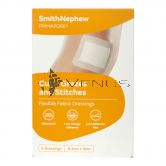 Smith & Nephew Primapore Flexible Fabric Dressings 5s