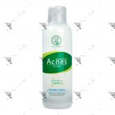 Acnes Powder Lotion 150ml